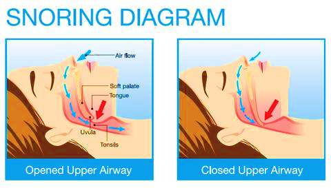 closed airways means snoring. reduce it with the proper pillow